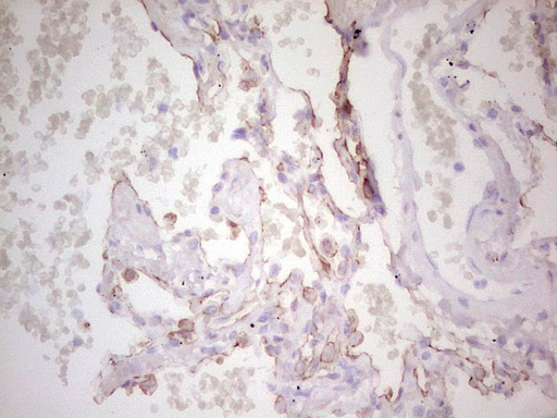 ABCB1 / MDR1 / P Glycoprotein Antibody - Immunohistochemical staining of paraffin-embedded Human lung tissue within the normal limits using anti-ABCB1 mouse monoclonal antibody. (Heat-induced epitope retrieval by 1 mM EDTA in 10mM Tris, pH8.5, 120C for 3min,