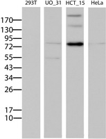 ABCB1 / MDR1 / P Glycoprotein Antibody - Western blot of extracts (15ug) from 4 different cell lines by using anti-ABCB1 monoclonal antibody (Lane 1: 293T; Lane 2: UO_31; Lane 3: HCT_115; Lane 4: HeLa).