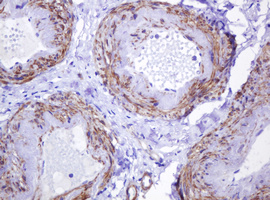 ABCB1 / MDR1 / P Glycoprotein Antibody - IHC of paraffin-embedded Human Ovary tissue using anti-ABCB1 mouse monoclonal antibody. (Heat-induced epitope retrieval by 10mM citric buffer, pH6.0, 120°C for 3min).
