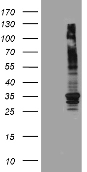 ABCB1 / MDR1 / P Glycoprotein Antibody - HEK293T cells were transfected with the pCMV6-ENTRY control. (Left lane) or pCMV6-ENTRY ABCB1. (Right lane) cDNA for 48 hrs and lysed. Equivalent amounts of cell lysates. (5 ug per lane) were separated by SDS-PAGE and immunoblotted with anti-ABCB1. (1:2000)
