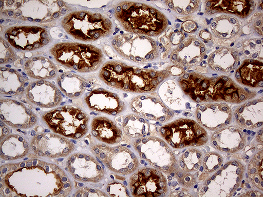 ABCB1 / MDR1 / P Glycoprotein Antibody - Immunohistochemical staining of paraffin-embedded Human Kidney tissue within the normal limits using anti-ABCB1 mouse monoclonal antibody. (Heat-induced epitope retrieval by 1mM EDTA in 10mM Tris buffer. (pH8.5) at 120°C for 3 min. (1:150)