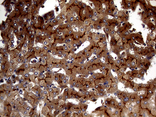 ABCB1 / MDR1 / P Glycoprotein Antibody - Immunohistochemical staining of paraffin-embedded Human liver tissue within the normal limits using anti-ABCB1 mouse monoclonal antibody. (Heat-induced epitope retrieval by 1mM EDTA in 10mM Tris buffer. (pH8.5) at 120°C for 3 min. (1:150)