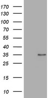 ABCB1 / MDR1 / P Glycoprotein Antibody - HEK293T cells were transfected with the pCMV6-ENTRY control (Left lane) or fragment (995-1280 AA) of ABCB1 (Right lane) cDNA for 48 hrs and lysed. Equivalent amounts of cell lysates (5 ug per lane) were separated by SDS-PAGE and immunoblotted with anti-ABCB1.