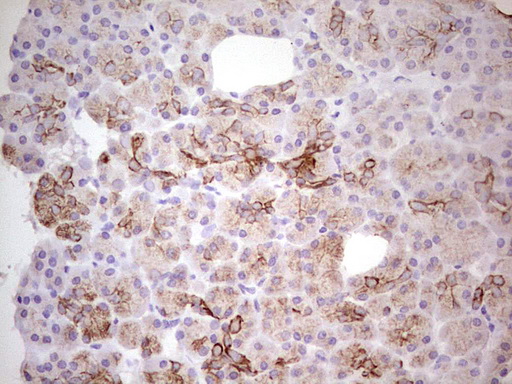ABCB1 / MDR1 / P Glycoprotein Antibody - Immunohistochemical staining of paraffin-embedded Human pancreas tissue within the normal limits using anti-ABCB1 mouse monoclonal antibody. (Heat-induced epitope retrieval by 1 mM EDTA in 10mM Tris, pH8.5, 120C for 3min,