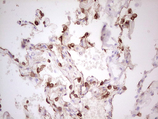 ABCB1 / MDR1 / P Glycoprotein Antibody - IHC of paraffin-embedded Human lung tissue using anti-ABCB1 mouse monoclonal antibody. (Heat-induced epitope retrieval by 1 mM EDTA in 10mM Tris, pH8.5, 120°C for 3min).