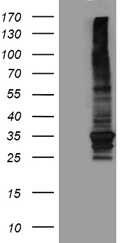 ABCB1 / MDR1 / P Glycoprotein Antibody - HEK293T cells were transfected with the pCMV6-ENTRY control. (Left lane) or pCMV6-ENTRY ABCB1. (Right lane) cDNA for 48 hrs and lysed. Equivalent amounts of cell lysates. (5 ug per lane) were separated by SDS-PAGE and immunoblotted with anti-ABCB1. (1:2000)