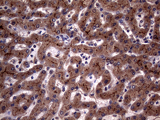 ABCB1 / MDR1 / P Glycoprotein Antibody - Immunohistochemical staining of paraffin-embedded Human liver tissue within the normal limits using anti-ABCB1 mouse monoclonal antibody. (Heat-induced epitope retrieval by 1mM EDTA in 10mM Tris buffer. (pH8.5) at 120°C for 3 min. (1:2000)