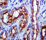 ABCB1 / MDR1 / P Glycoprotein Antibody - IHC of MDR-1 on FFPE tissue. This image was taken for the unmodified form of this product. Other forms have not been tested.
