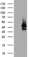 ABCB1 / MDR1 / P Glycoprotein Antibody - HEK293T cells were transfected with the pCMV6-ENTRY control (Left lane) or fragment (347-710 AA) of ABCB1 (Right lane) cDNA for 48 hrs and lysed. Equivalent amounts of cell lysates (5 ug per lane) were separated by SDS-PAGE and immunoblotted with anti-ABCB1.