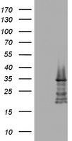 ABCB1 / MDR1 / P Glycoprotein Antibody - HEK293T cells were transfected with the pCMV6-ENTRY control (Left lane) or fragment (995-1280 AA) of ABCB1 (Right lane) cDNA for 48 hrs and lysed. Equivalent amounts of cell lysates (5 ug per lane) were separated by SDS-PAGE and immunoblotted with anti-ABCB1. .