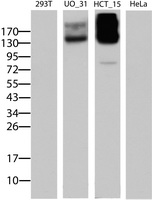 ABCB1 / MDR1 / P Glycoprotein Antibody - Western blot of extracts (15 ug) from 4 different cell lines by using anti-ABCB1 monoclonal antibody (Lane 1: 293T; Lane 2: UO_31; Lane 3: HCT_115; Lane 4: HeLa).