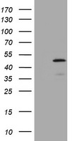 ABCB1 / MDR1 / P Glycoprotein Antibody - SF9 cells lysate (5 ug, left lane) and SF9 cells lysate expressing human recombinant protein fragment (5 ug, right lane) corresponding to amino acids 995-1280 of human ABCB1 (NP_000918) were separated by SDS-PAGE and immunoblotted with anti-ABCB1.