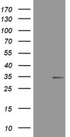 ABCB1 / MDR1 / P Glycoprotein Antibody - Mock SF9 cells lysate (5 ug, left lane) and SF9 cells lysate expressing human recombinant protein fragment (5 ug, right lane) corresponding to amino acids 995-1280 of human ABCB1 (NP_000918) were separated by SDS-PAGE and immunoblotted with anti-ABCB1.