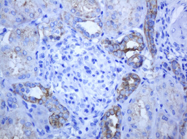 ABCB1 / MDR1 / P Glycoprotein Antibody - IHC of paraffin-embedded Human Kidney tissue using anti-ABCB1 mouse monoclonal antibody.