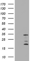 ABCB1 / MDR1 / P Glycoprotein Antibody - SF9 cells lysate (5 ug, left lane) and SF9 cells lysate expressing human recombinant protein fragment (5 ug, right lane) corresponding to amino acids 995-1280 of human ABCB1 (NP_000918) were separated by SDS-PAGE and immunoblotted with anti-ABCB1.