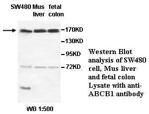 ABCB1 / MDR1 / P Glycoprotein Antibody