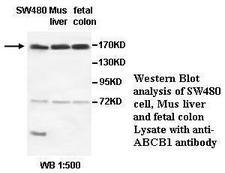 ABCB1 / MDR1 / P Glycoprotein Antibody