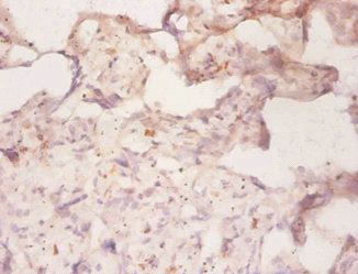 ABCB1 / MDR1 / P Glycoprotein Antibody - Immunohistochemistry of paraffin-embedded human placenta tissue using ABCB1 Antibody at dilution of 1:50