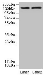 ABCB1 / MDR1 / P Glycoprotein Antibody - Western blot All lanes: Multidrµg resistance protein 1 antibody at 2µg/ml Lane 1: HepG2 whole cell lysate Lane 2: EC109 whole cell lysate Secondary Goat polyclonal to rabbit IgG at 1/10000 dilution Predicted band size: 142, 135 kDa Observed band size: 142 kDa