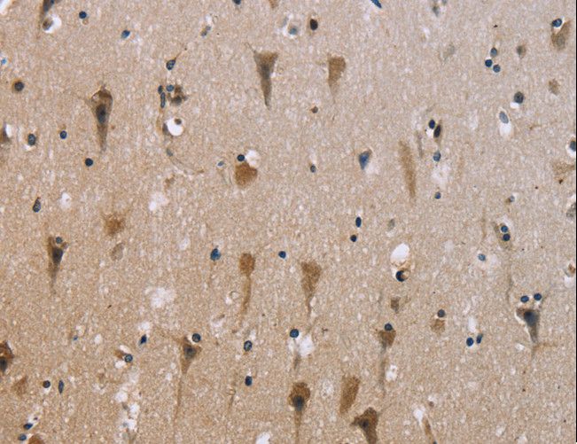 ABCB1 / MDR1 / P Glycoprotein Antibody - Immunohistochemistry of paraffin-embedded Human brain using ABCB1 Polyclonal Antibody at dilution of 1:30.