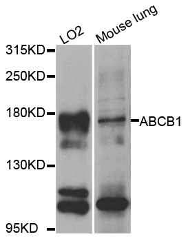 ABCB1 / MDR1 / P Glycoprotein Antibody - Western blot analysis of extracts of various cell lines, using ABCB1 antibody at 1:1000 dilution. The secondary antibody used was an HRP Goat Anti-Rabbit IgG (H+L) at 1:10000 dilution. Lysates were loaded 25ug per lane and 3% nonfat dry milk in TBST was used for blocking. An ECL Kit was used for detection and the exposure time was 30s.