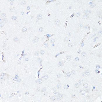 ABCB1 / MDR1 / P Glycoprotein Antibody - Immunohistochemistry of paraffin-embedded rat brain endothelial cells using ABCB1 antibody at dilution of 1:100 (40x lens).