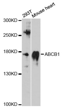 ABCB1 / MDR1 / P Glycoprotein Antibody - Western blot analysis of extracts of various cell lines, using ABCB1 antibody at 1:3000 dilution. The secondary antibody used was an HRP Goat Anti-Rabbit IgG (H+L) at 1:10000 dilution. Lysates were loaded 25ug per lane and 3% nonfat dry milk in TBST was used for blocking. An ECL Kit was used for detection and the exposure time was 90s.