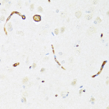 ABCB1 / MDR1 / P Glycoprotein Antibody - Immunohistochemistry of paraffin-embedded rat brain using ABCB1 antibody at dilution of 1:100 (40x lens).