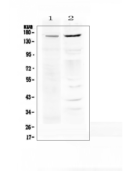 ABCB1 / MDR1 / P Glycoprotein Antibody - Western blot analysis of P Glycoprotein using anti-P Glycoprotein antibody. Electrophoresis was performed on a 5-20% SDS-PAGE gel at 70V (Stacking gel) / 90V (Resolving gel) for 2-3 hours. The sample well of each lane was loaded with 50ug of sample under reducing conditions. Lane 1: human THP-1 whole cell lysates,Lane 2: human A375 whole cell lysates. After Electrophoresis, proteins were transferred to a Nitrocellulose membrane at 150mA for 50-90 minutes. Blocked the membrane with 5% Non-fat Milk/ TBS for 1.5 hour at RT. The membrane was incubated with rabbit anti-P Glycoprotein antigen affinity purified polyclonal antibody at 0.5 ?g/mL overnight at 4?C, then washed with TBS-0.1% Tween 3 times with 5 minutes each and probed with a goat anti-rabbit IgG-HRP secondary antibody at a dilution of 1:10000 for 1.5 hour at RT. The signal is developed using an Enhanced Chemiluminescent detection (ECL) kit with Tanon 5200 system. A specific band was detected for P Glycoprotein at approximately 160KD. The expected band size for P Glycoprotein is at 141KD.