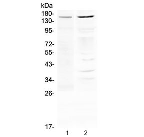 ABCB1 / MDR1 / P Glycoprotein Antibody - Western blot testing of human 1) THP-1 and 2) A375 cell lysate with P Glycoprotein antibody at 0.5ug/ml. Expected molecular weight: 141-180 kDa depending on glycosylation level.