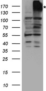 ABCB1 / MDR1 / P Glycoprotein Antibody - HEK293T cells were transfected with the pCMV6-ENTRY control. (Left lane) or pCMV6-ENTRY ABCB1. (Right lane) cDNA for 48 hrs and lysed. Equivalent amounts of cell lysates. (5 ug per lane) were separated by SDS-PAGE and immunoblotted with anti-ABCB1 rabbit polyclonal antibody.
