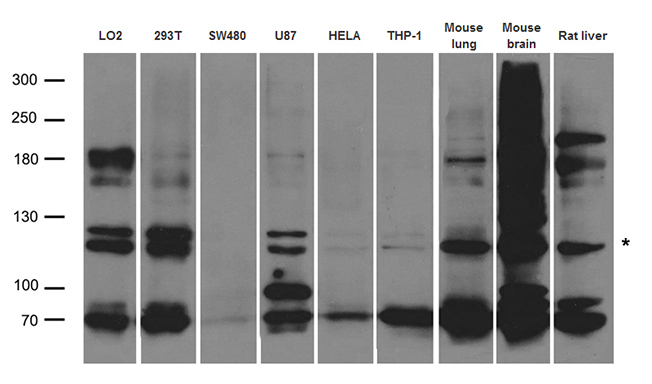 ABCB1 / MDR1 / P Glycoprotein Antibody - Western blot analysis of extracts. (35ug) from different cell lines and tissues by using anti-ABCB1 rabbit polyclonal antibody.