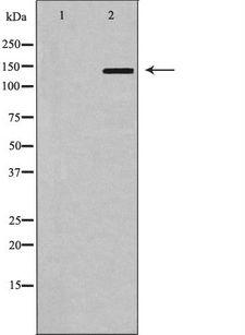 ABCB1 / MDR1 / P Glycoprotein Antibody - Western blot analysis of MDR1 using HT29 whole cells lysates. The lane on the left is treated with the antigen-specific peptide.
