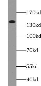 ABCB1 / MDR1 / P Glycoprotein Antibody - HepG2 cells were subjected to SDS PAGE followed by western blot with P glycoprotein antibody at dilution of 1:300