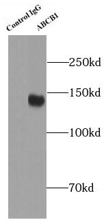 ABCB1 / MDR1 / P Glycoprotein Antibody - Result of anti-P glycoprotein (IP: anti-P Glycoprotein antibody 4ug; Detection: anti-P Glycoprotein antibody) with human placenta tissue lysate 4000ug.