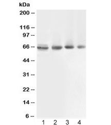 ABCB10 Antibody - Western blot testing of 1) rat muscle, 2) human COLO320, 3) human 22RV1 and 4) human PANC lysate with ABCB10 antibody at 0.5ug/ml. Expected molecular weight: ~79 kDa (full), ~65 kDa (cleaved mitochondrial targeting sequence (amino acids 1-105)).