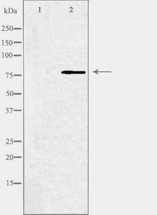 ABCB10 Antibody - Western blot analysis of extracts of COLO cells using ABCB10 antibody. The lane on the left is treated with the antigen-specific peptide.