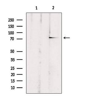 ABCB10 Antibody - Western blot analysis of extracts of rat brain tissue using ABCB10 antibody. Lane 1 was treated with the blocking peptide.