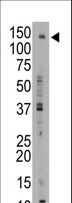 ABCB11 / BSEP Antibody - The anti-ABCB11 C-term antibody is used in Western blot to detect ABCB11 in mouse liver tissue lysate.