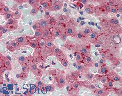 ABCB11 / BSEP Antibody - Human Liver: Formalin-Fixed, Paraffin-Embedded (FFPE)