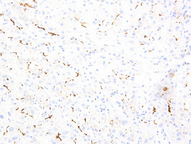 ABCB11 / BSEP Antibody - Stained on Human Liver Tissue
