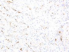 ABCB11 / BSEP Antibody - Stained on Human Liver Tissue