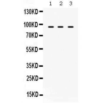 ABCB2 / TAP1 Antibody - TAP1 antibody Western blot. All lanes: Anti TAP1 at 0.5 ug/ml. Lane 1: HELA Whole Cell Lysate at 40 ug. Lane 2: HUT Whole Cell Lysate at 40 ug. Lane 3: SW620 Whole Cell Lysate at 40 ug. Predicted band size: 87 kD. Observed band size: 87 kD.