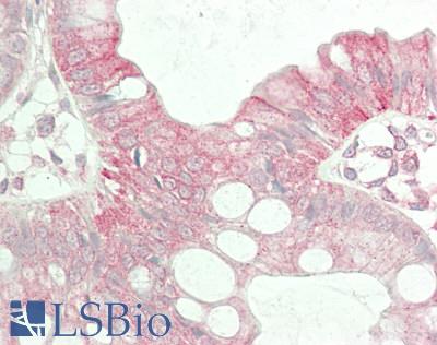 ABCB2 / TAP1 Antibody - Human Colon: Formalin-Fixed, Paraffin-Embedded (FFPE)