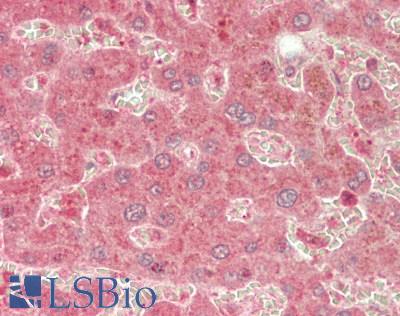 ABCB2 / TAP1 Antibody - Human Liver: Formalin-Fixed, Paraffin-Embedded (FFPE)