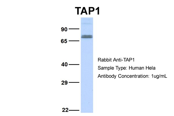 ABCB2 / TAP1 Antibody - Western blot of Anti-TAP1 Ab using HeLa cell lysate at a concentration of 1ug/mL.