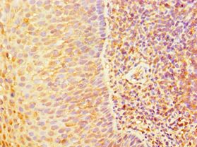 ABCB2 / TAP1 Antibody - Immunohistochemistry of paraffin-embedded human tonsil using antibody at 1:100 dilution.