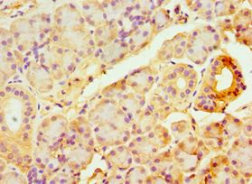 ABCB2 / TAP1 Antibody - Immunohistochemistry of paraffin-embedded human pancreas using antibody at 1:100 dilution.