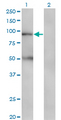 ABCB2 / TAP1 Antibody - Western blot of TAP1 expression in transfected 293T cell line by TAP1 monoclonal antibody (M03), clone 3D10.