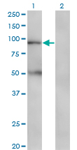 ABCB2 / TAP1 Antibody - Western blot of TAP1 expression in transfected 293T cell line by TAP1 monoclonal antibody (M03), clone 3D10.